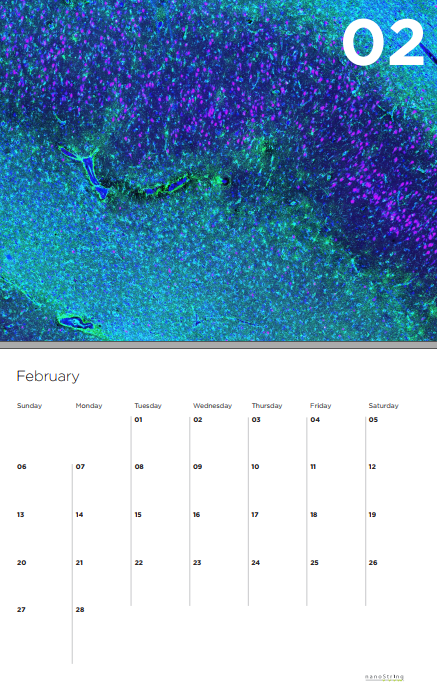 Calendar with tissue image in top half and February month grid on bottom