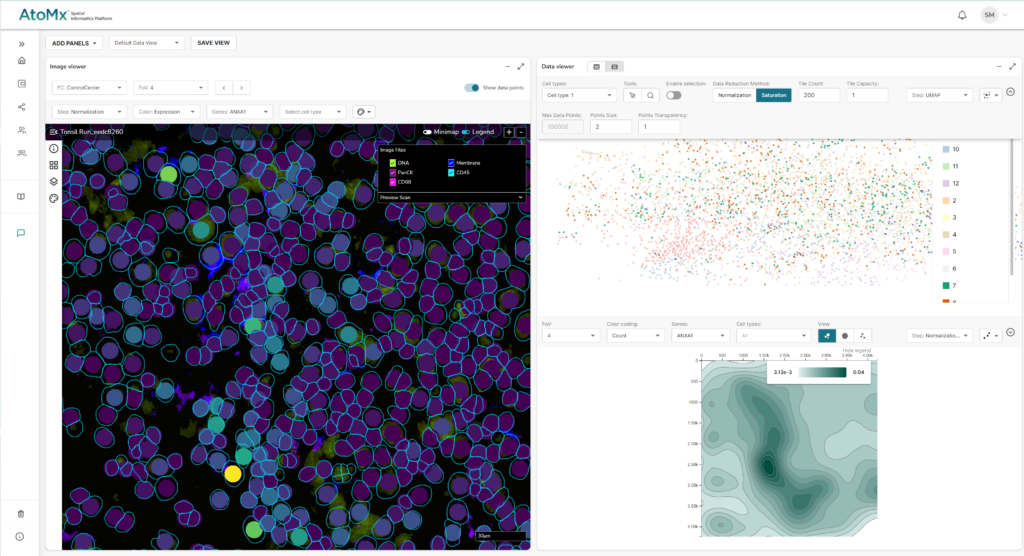 Overlay cell segmentation and normalized gene expression directly on your tissue and visualize CosMx SMI single-cell data real time with AtoMx SIP.