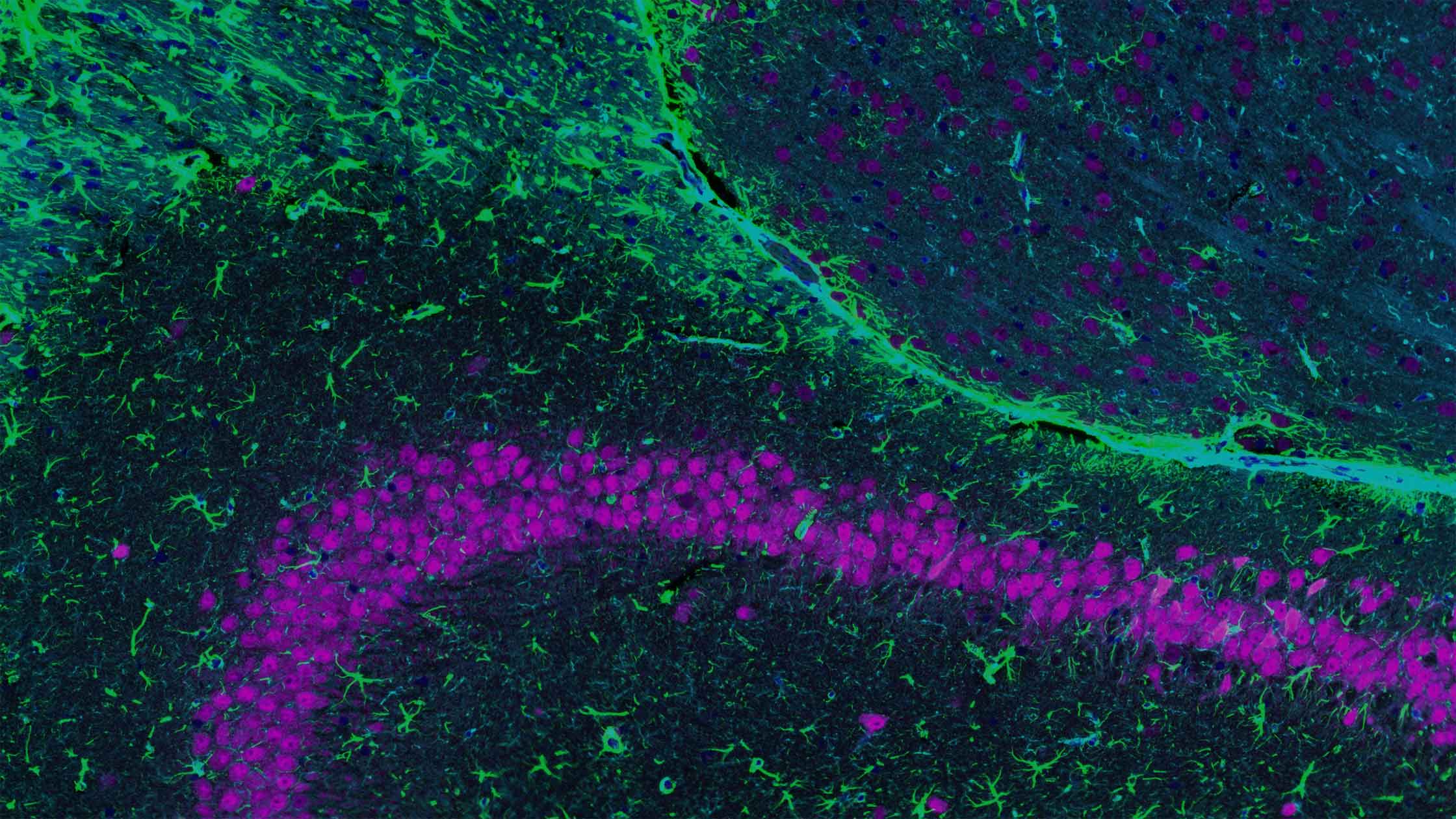 Spatial organ atlas nanostring