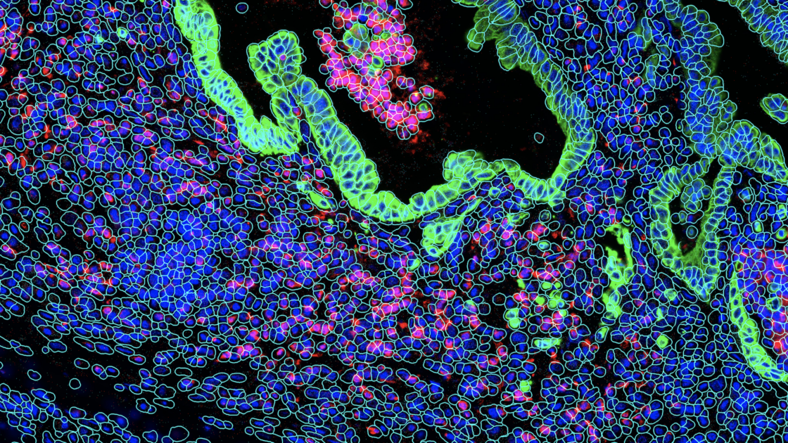 The Spatial Biology Week™ 2023 - Lunaphore Technologies