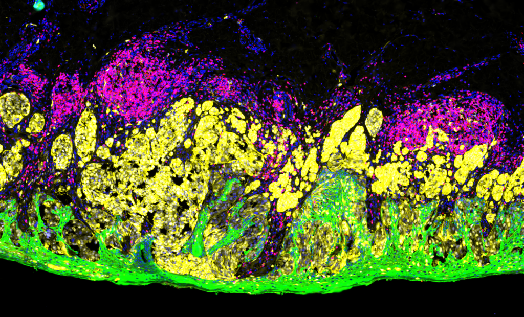 What is immunofluorescence used for? NanoString