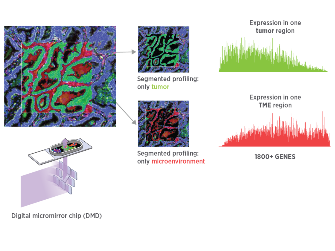 Illustration of GeoMx segmenting of only tumor or only microenvironment