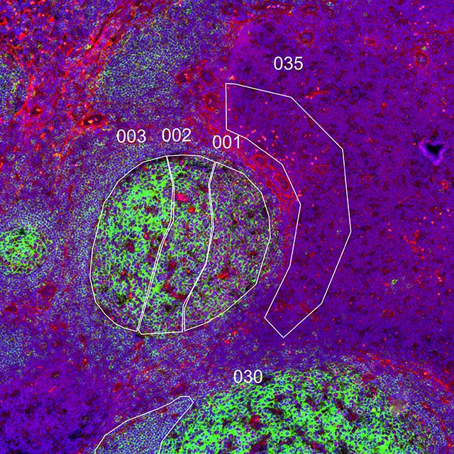 Lymph node from GeoMx