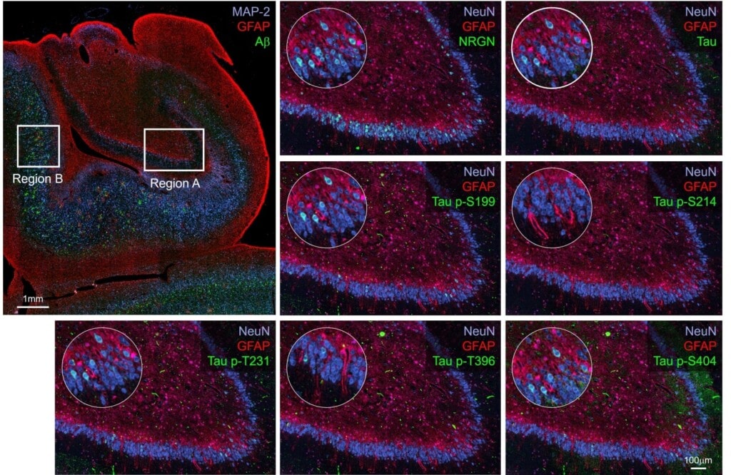 Zoomed-in sections of dentate gyrus brain tissue, stained for different Alzheimer’s Disease markers including NRGN, p62, Ubiquitin, and several phosphorylated-Tau proteins.