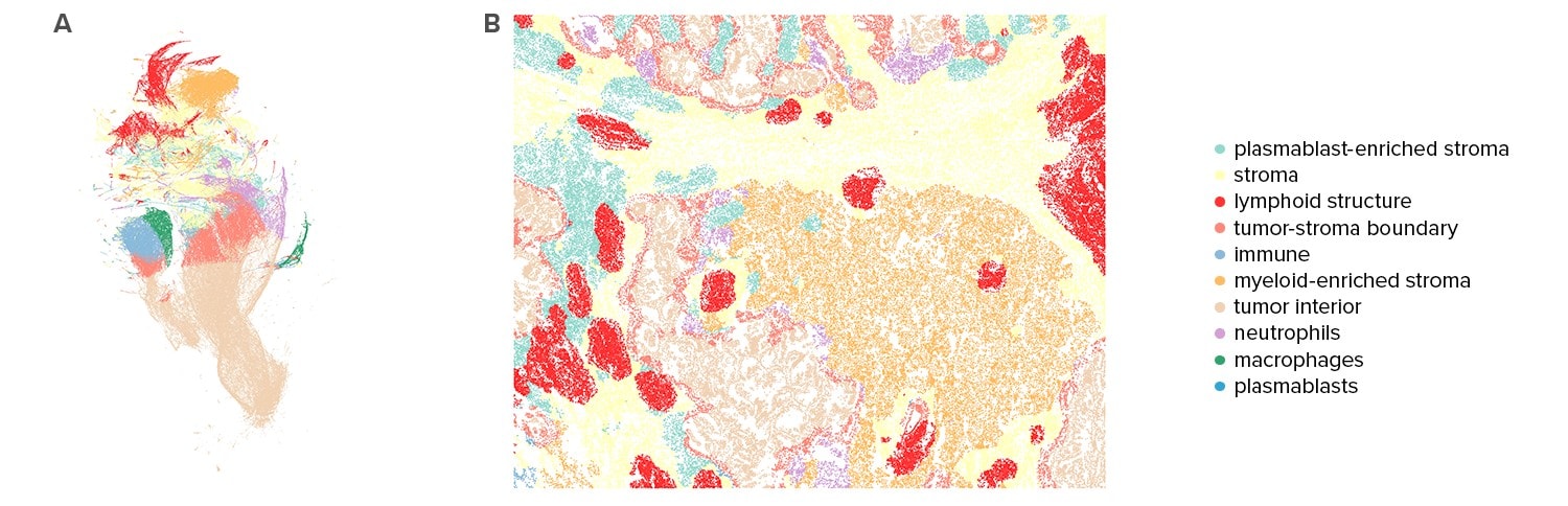 SMI data partitioned FFPE tissue sections into multiple distinct clusters