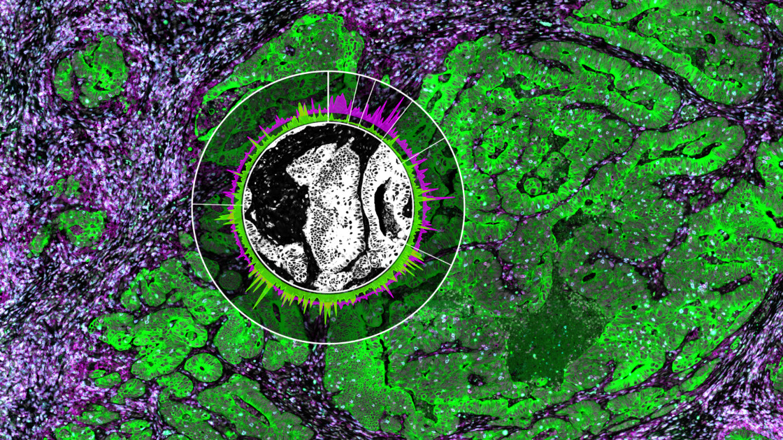 Deciphering Spatial Protein–Protein Interactions in Brain Using