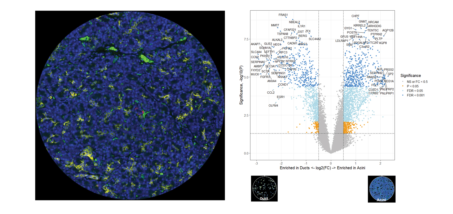 Whole transcriptome analysis of structural compartments in the pancreas