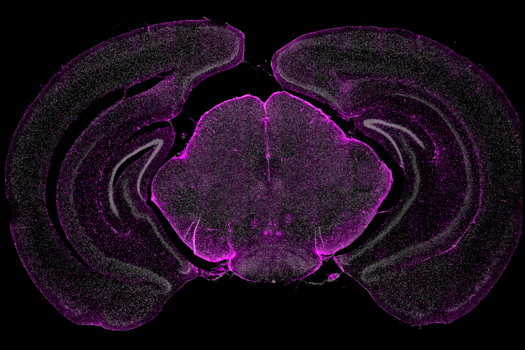 High plex in situ profiling of mouse brain sections with CosMx™ SMI
