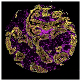 Sample image showing segmentation for spatial multiomics