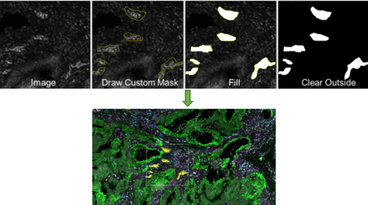 Segmentation and masking at work with GeoMx: now the user can see the molecular conversation between cells