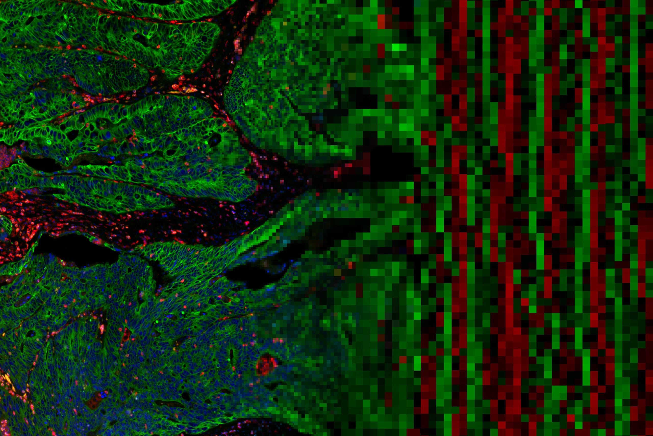 Tissue analysis