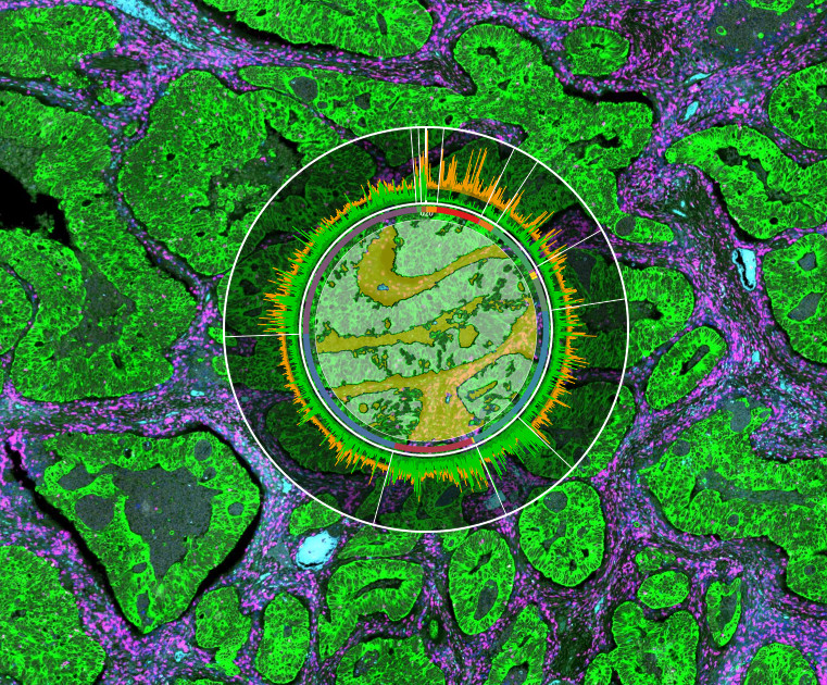 an-introduction-to-spatial-biology-and-spatial-profiling-nanostring